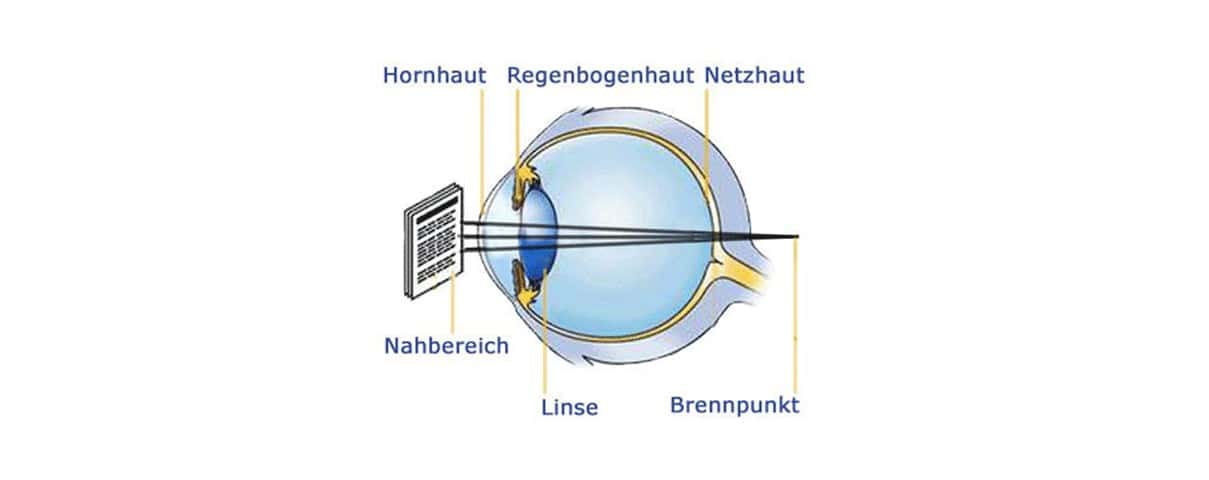 Augendiagnose mit Laserzentrum Wiesbaden, Fokus auf präzise Laserbehandlungen für Augengesundheit.