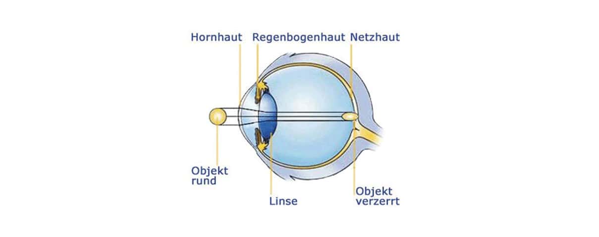 Illustration des Auges mit Beschriftungen zu Hornhaut, Netzhaut und Linse.